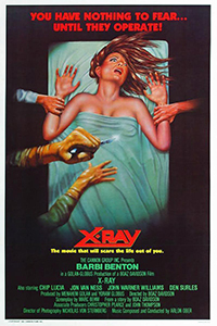 X-Ray